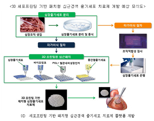 3D 세포프린팅 기반 패치형 심근경색 줄기세포 치료제 개발 예상 모식도(자료 : 서울성모병원)